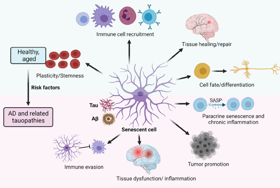 Il ruolo delle cellule senescenti nella malattia di Alzheimer